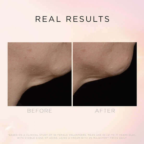 - Крем для шиї та декольте Cosmedix Illuminate Lift Neck Decollete 60г