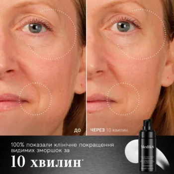 x22ae52bac204a698c13a9e011293.webp.pagespeed.ic .xvy6thvuzl - Інноваційна сироватка Medik8 Liquid Peptides Advanced MP 30мл