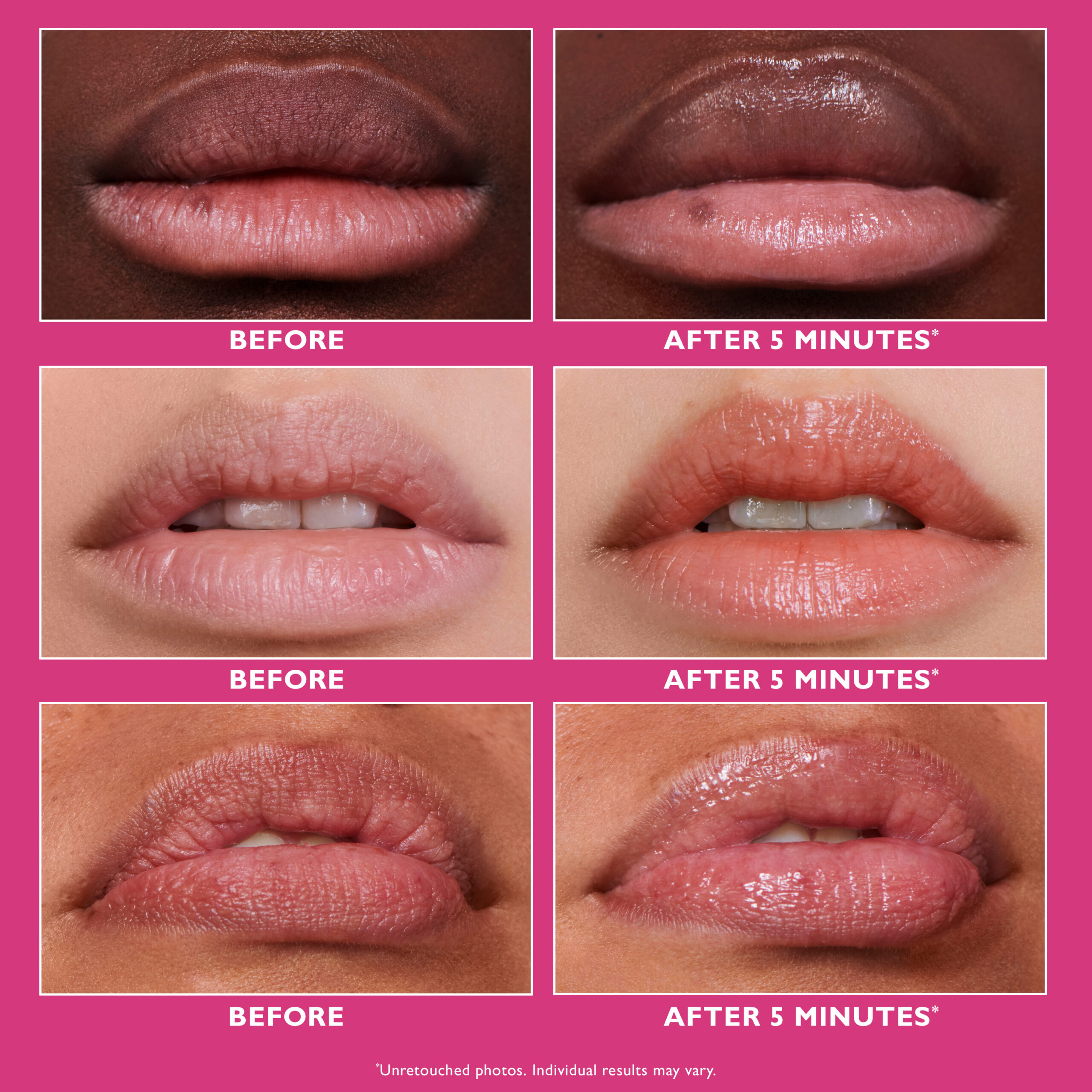 27 01 007 ifx lip beforeafter 3000x3000 300dpi scaled - Бальзам філер для збільшення об'єму губ Peter Thomas Roth Instant FIRMx® Lip Filler 10мл