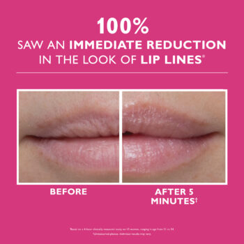 27 01 007 ifx lip beforeafter split 3000x3000 300dpi - Бальзам філер для збільшення об'єму губ Peter Thomas Roth Instant FIRMx® Lip Filler 10мл