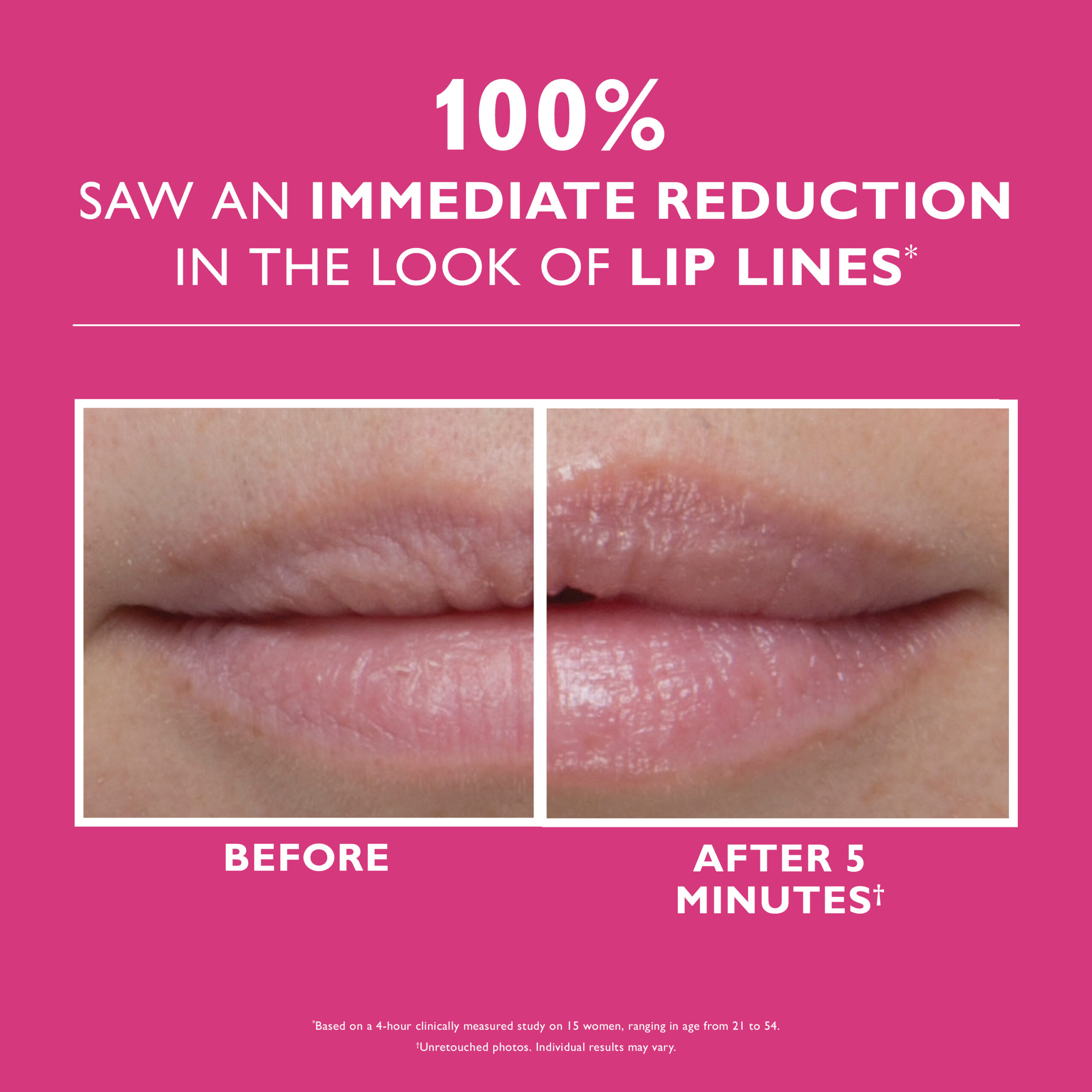 27 01 007 ifx lip beforeafter split 3000x3000 300dpi scaled - Бальзам філер для збільшення об'єму губ Peter Thomas Roth Instant FIRMx® Lip Filler 10мл