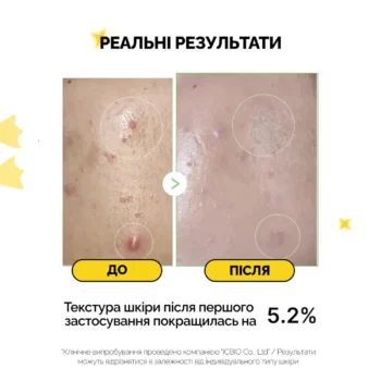 medicube exosome cica ampoule 30 ml 13744509582555 - Заспокійлива сироватка з екзосомами центели та чайним деревом Medicube Exosome Cica Ampoule 30мл