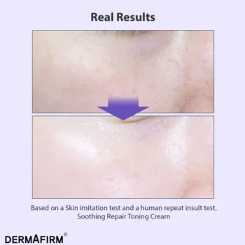 soothing repair toning cream r4 20798036321617 - Тонізуючий крем з глутатіоном та бакучіолом Dermafirm Soothing Repair Toning Cream R4 50мл