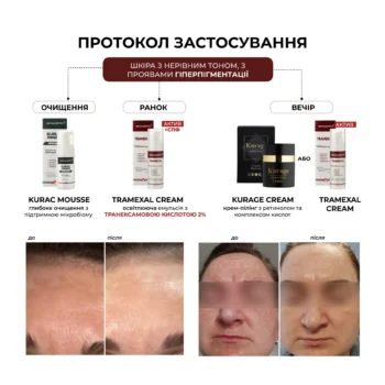 1 - Освітлюючий крем проти пігментації Braderm Tramexal Cream 30мл