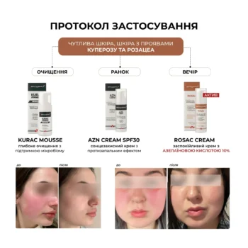 40753893935194 - Заспокійливий крем для чутливої шкіри Braderm Rosac Cream 30мл