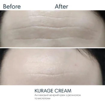 krem pilinh z retynolom ta kyslotamy 78745288363005 - Крем-пілінг з ретинолом та кислотами Braderm Kurage Cream 30мл