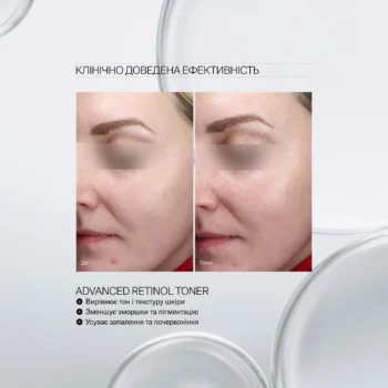 advanced retinol toner 03 - Інтенсивний оновлювальний тонер з ретинолом Instytutum Advanced Retinol Toner Next-Gen 150мл