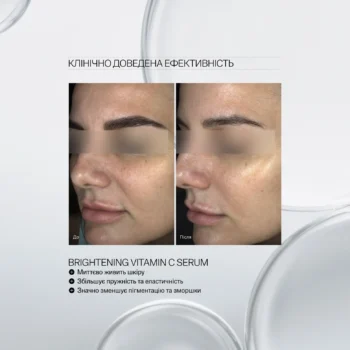 brightening vitamin c serum 02 - Суперконцентрований серум з вітаміном С Instytutum Brightening Vitamin C Serum Next-Gen 30мл