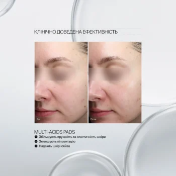 multi acids pads - Пілінг-пади з кислотами для глибокого оновлення шкіри Instytutum Resurfacing Multi-Acids Pads Next-Gen 60шт