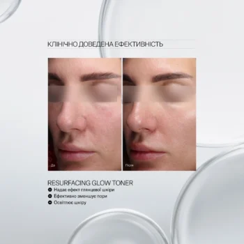 resurfacing glow toner 02 - Тонер з AHA & PHA кислотами Instytutum Resurfacing Glow Toner Next-Gen 100мл