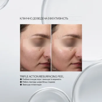 triple action resurfacing peel 02 - Пілінг для обличчя потрійної дії Instytutum Triple Action Resurfacing Peel Next-Gen 60мл