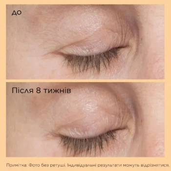 xcbc8f4dfb946dcbd4eb52d1e15f0.webp.pagespeed.ic .uqvgzlubbj - Сироватка-ліфтинг для повік з нейропептидами Perricone MD Neuropeptide Eyelid Lift Serum 15мл