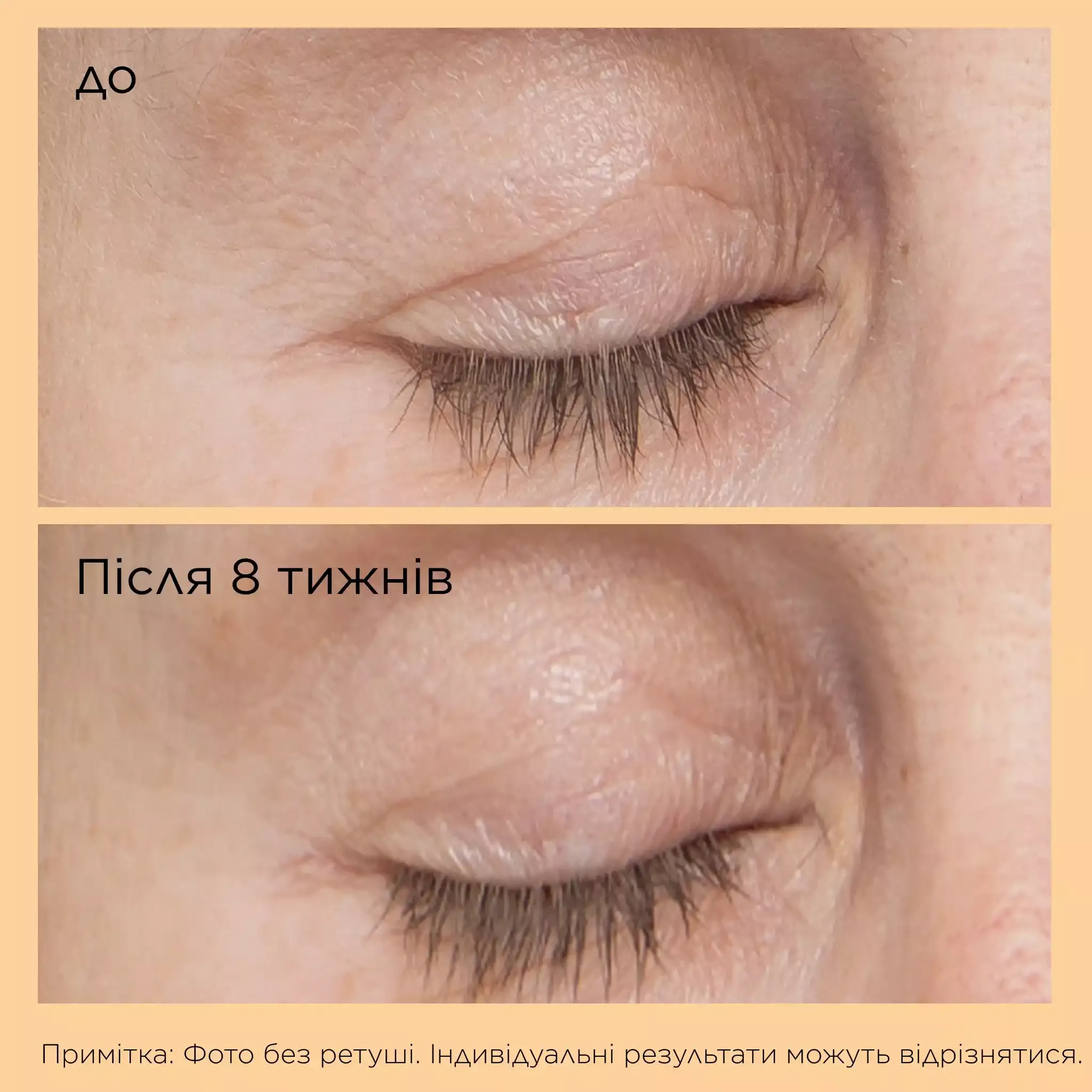 - Сироватка-ліфтинг для повік з нейропептидами Perricone MD Neuropeptide Eyelid Lift Serum 15мл