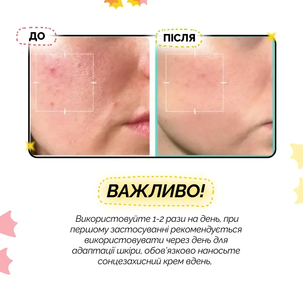 medicube azelaic acid 16 bb calming serum 30 ml 70726559399030 - Заспокійлива сироватка з 16% азелаїнової кислоти Medicube Azelaic Acid 16% Calming Serum 30мл